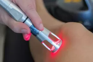 Cold-Laser-Therapy
